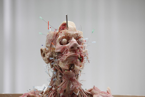 Plastination