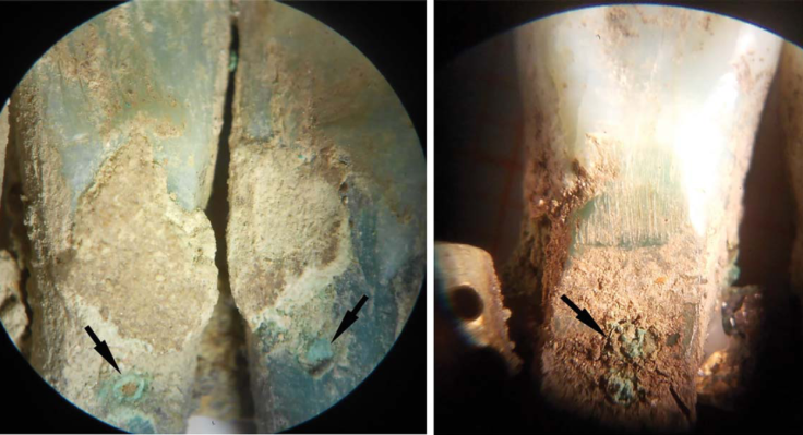 earliest dental prosthesis