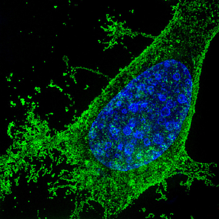 HIV infected cell
