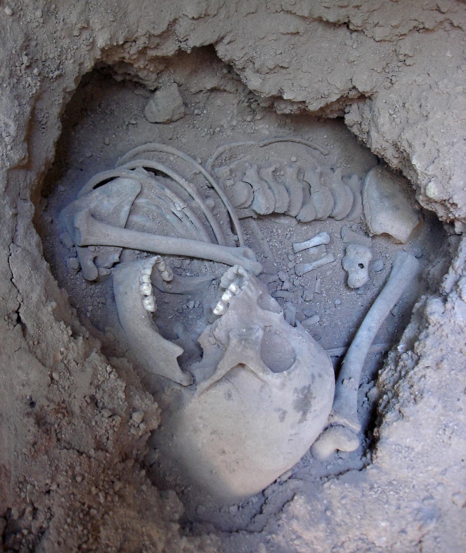 burial skeletal remains