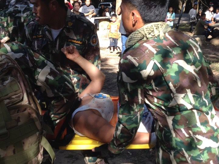 Woman bitten by crocodile on stretcher Woman bitten by crocodile on stretcher