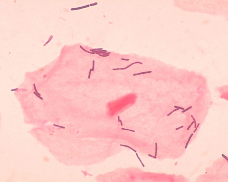 lactobacillus