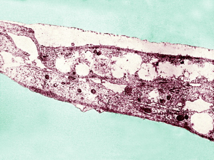 Syphilis bacteria