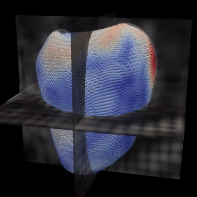 LMS 3D virtual heart