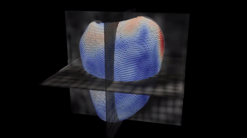 LMS 3D virtual heart