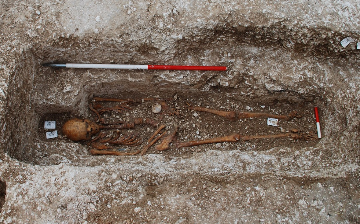 leprosy skeleton leprosy skeleton