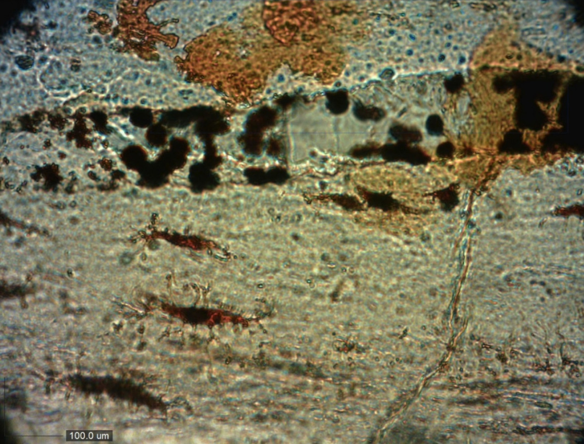 Vascular canal Vascular canal