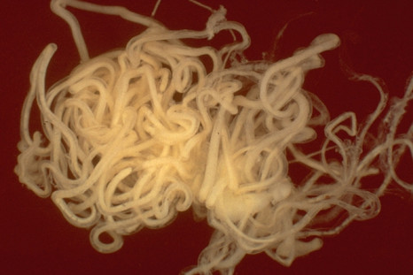 nodding syndrome parasitic worm