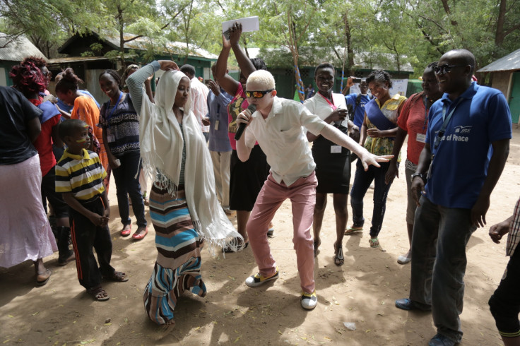 Young Burundian albino