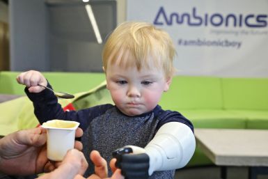 The Ambionics prosthetic arm for infants 