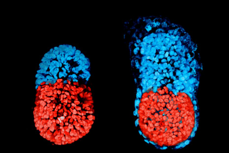 embryo mouse