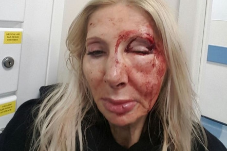 Austrian tourist beaten in London