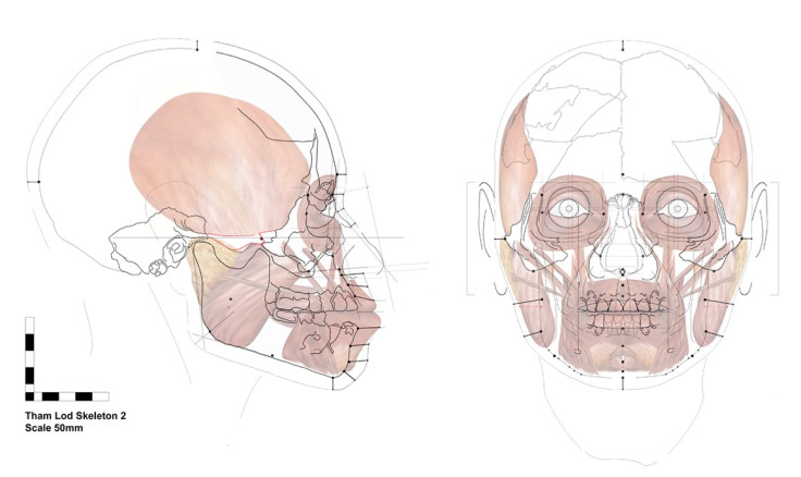 Facial approximation