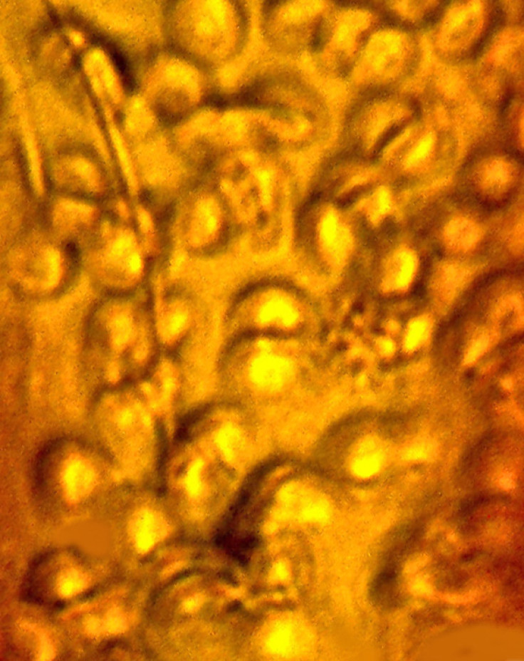 Fossilized red blood cells