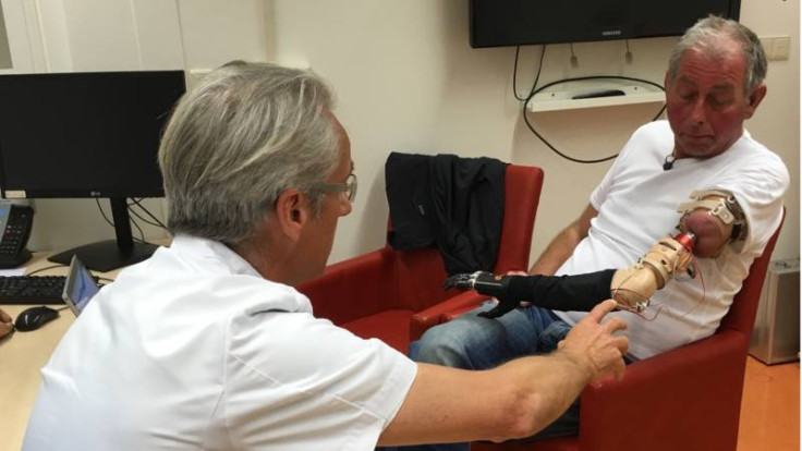 Robotic arm controlled by patient's thoughts Robotic arm controlled by patient's thoughts
