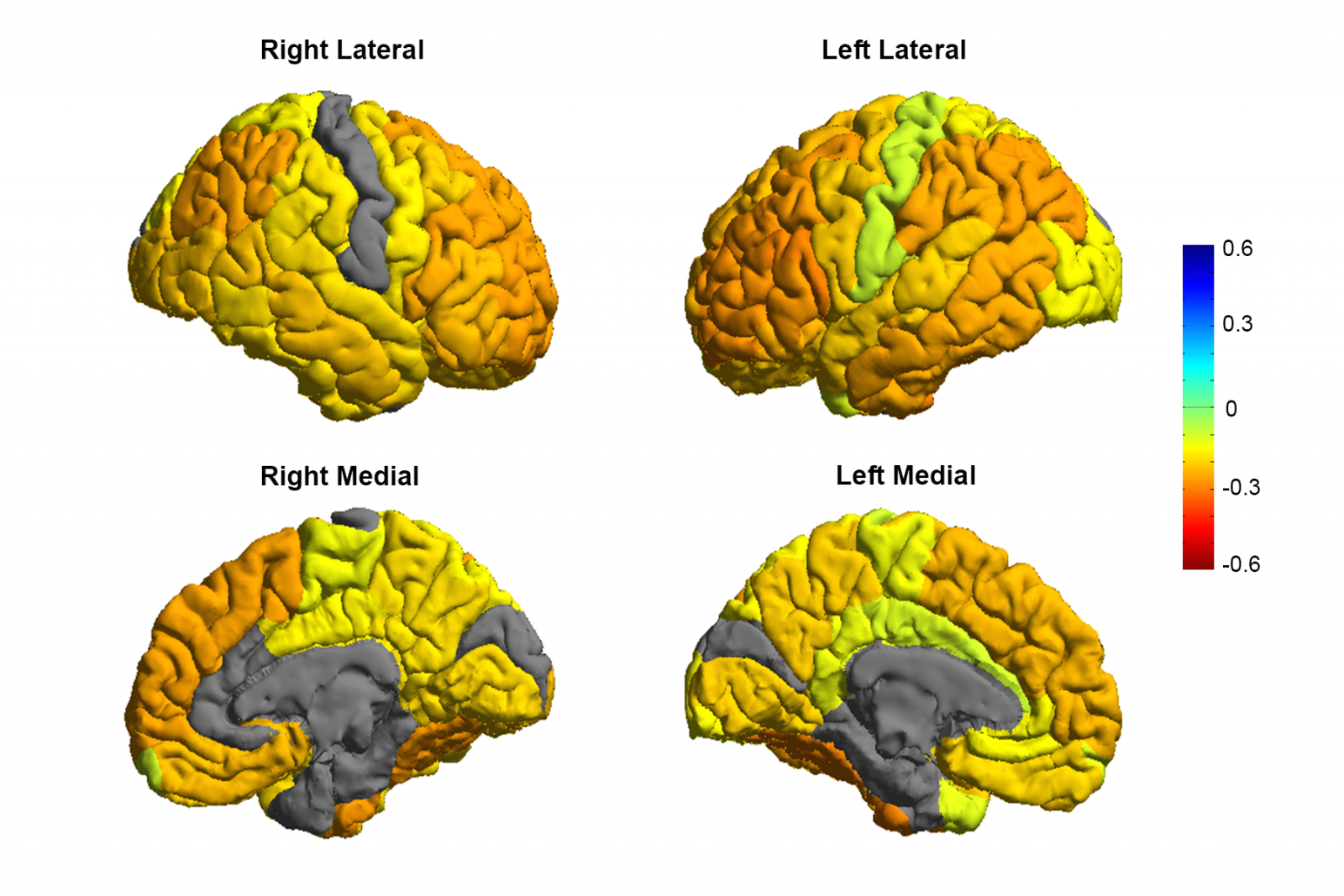 Scientists Reveal The First Ever Map Of The Bipolar Brain