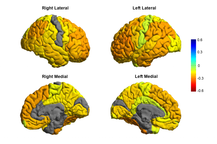 Bipolar