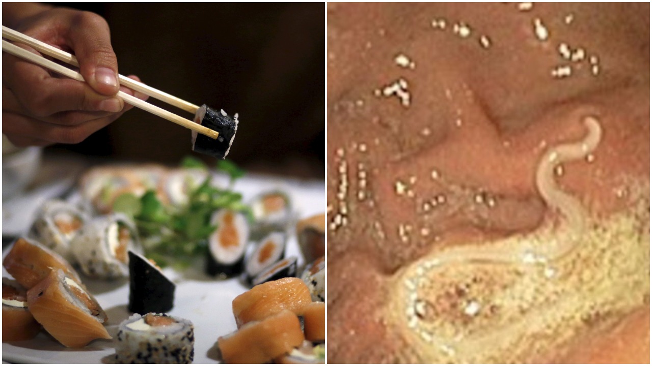 Love sushi? Doctors warn of rise in dangerous parasitic ...