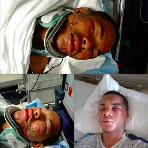 Monte Stewart NJ teen beaten by police Monte Stewart NJ teen beaten by police