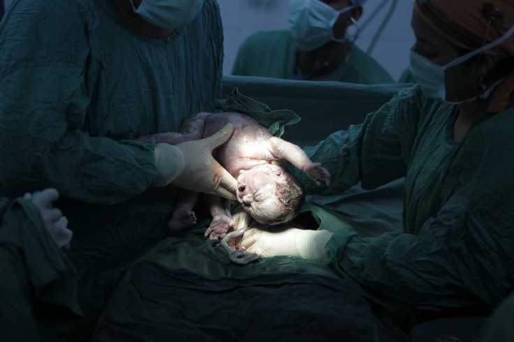 Caesarean section