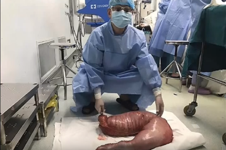 28 pounds of feces removed 