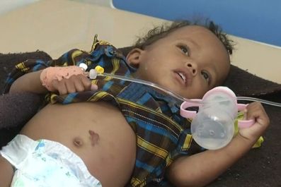 Yemen Cholera Epidemic Spreads With Nearly 250,000 Infected