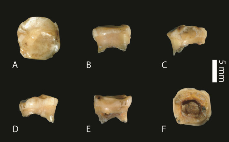 Denisovan fossil