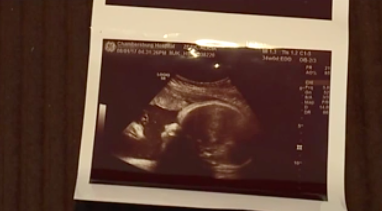 Couple say ultrasound 'shows Jesus looking over their baby'