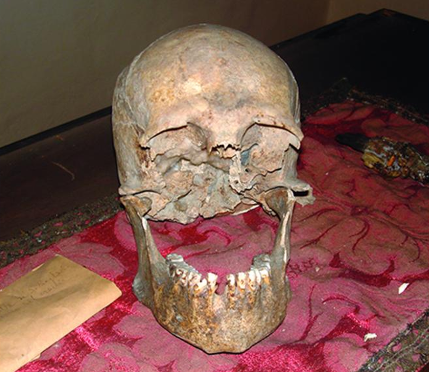 Is this the skull of Pliny the Elder, hero of Pompeii?