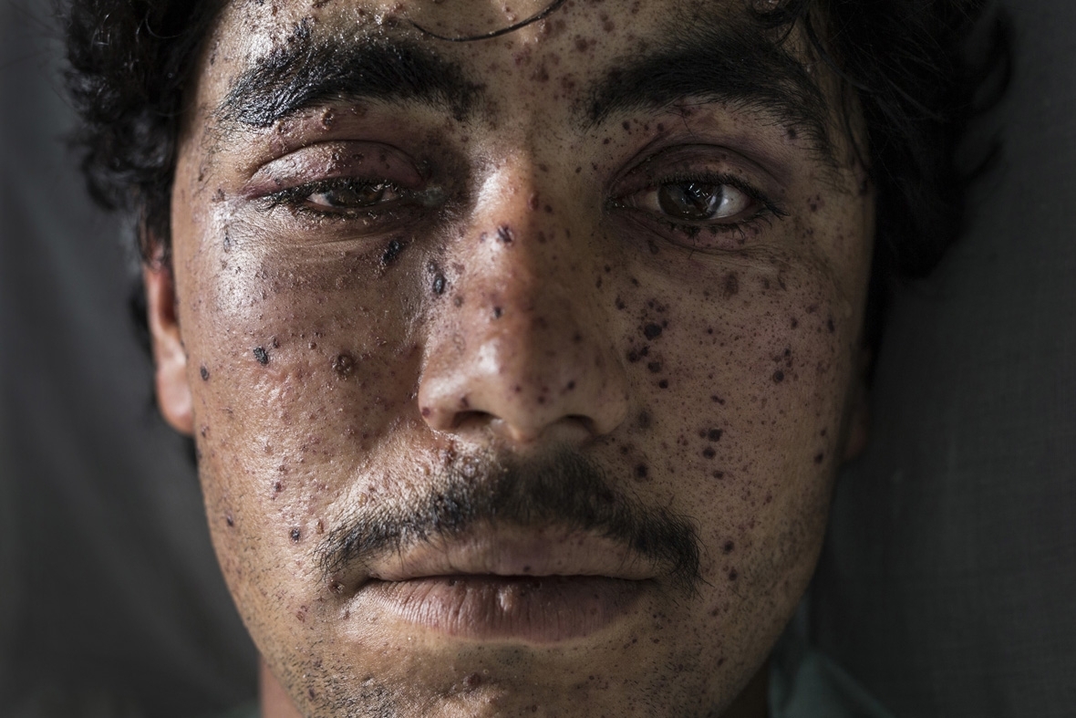 Getty Images awards five photojournalists 10,000 grant to pursue projects