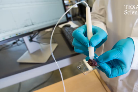 New 'pen' device accurately identifies cancer in 10 seconds