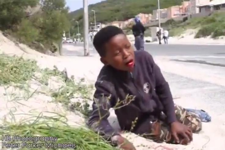 Hout Bay South Africa Boy Shot Mouth