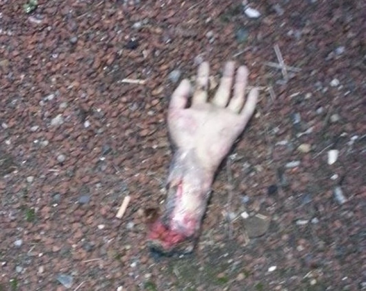 severed hand