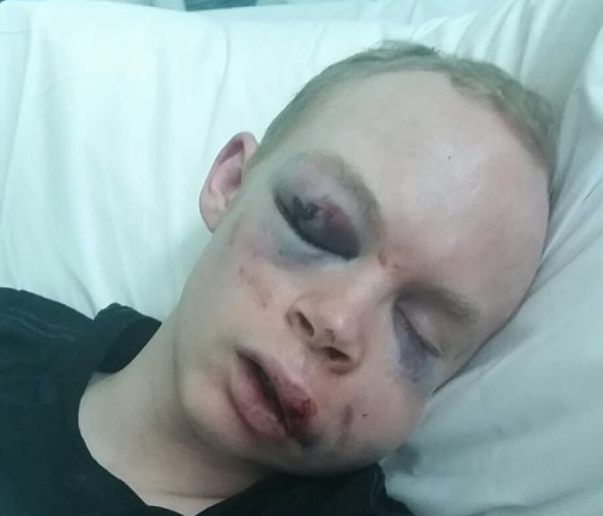 Callum Wade assaulted in London