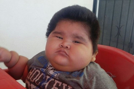 World's fattest baby