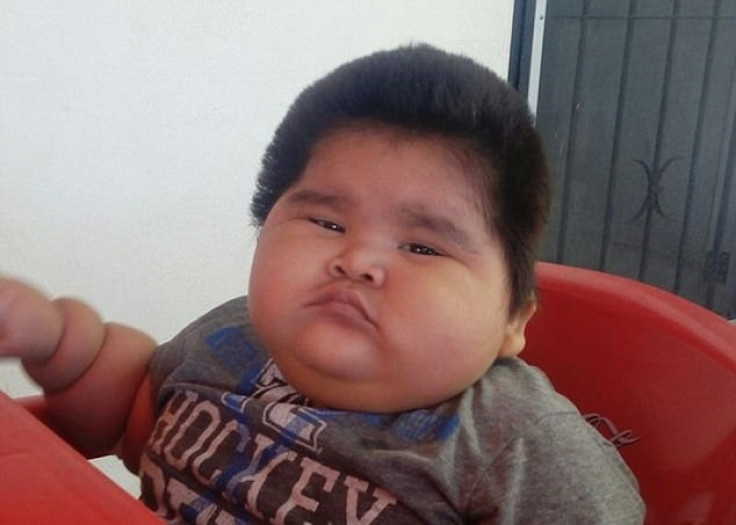 World's fattest baby
