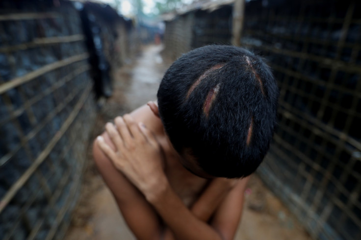 Rohingya Muslim refugee injuries