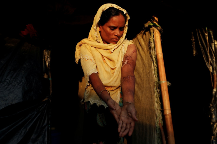 Rohingya Muslim refugee injuries