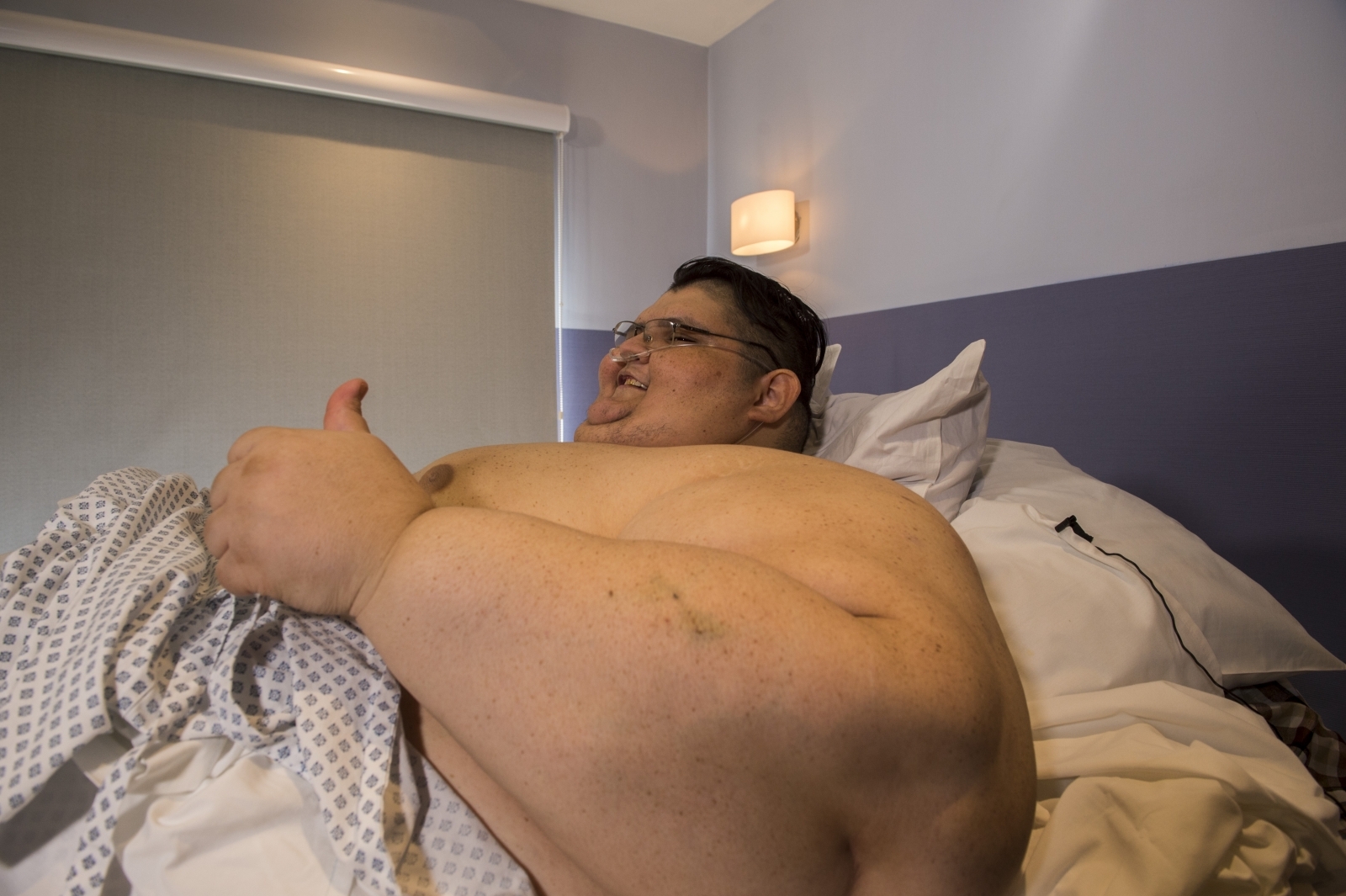 Watch 'World's fattest man' undergo surgery to reduce 95 sto...