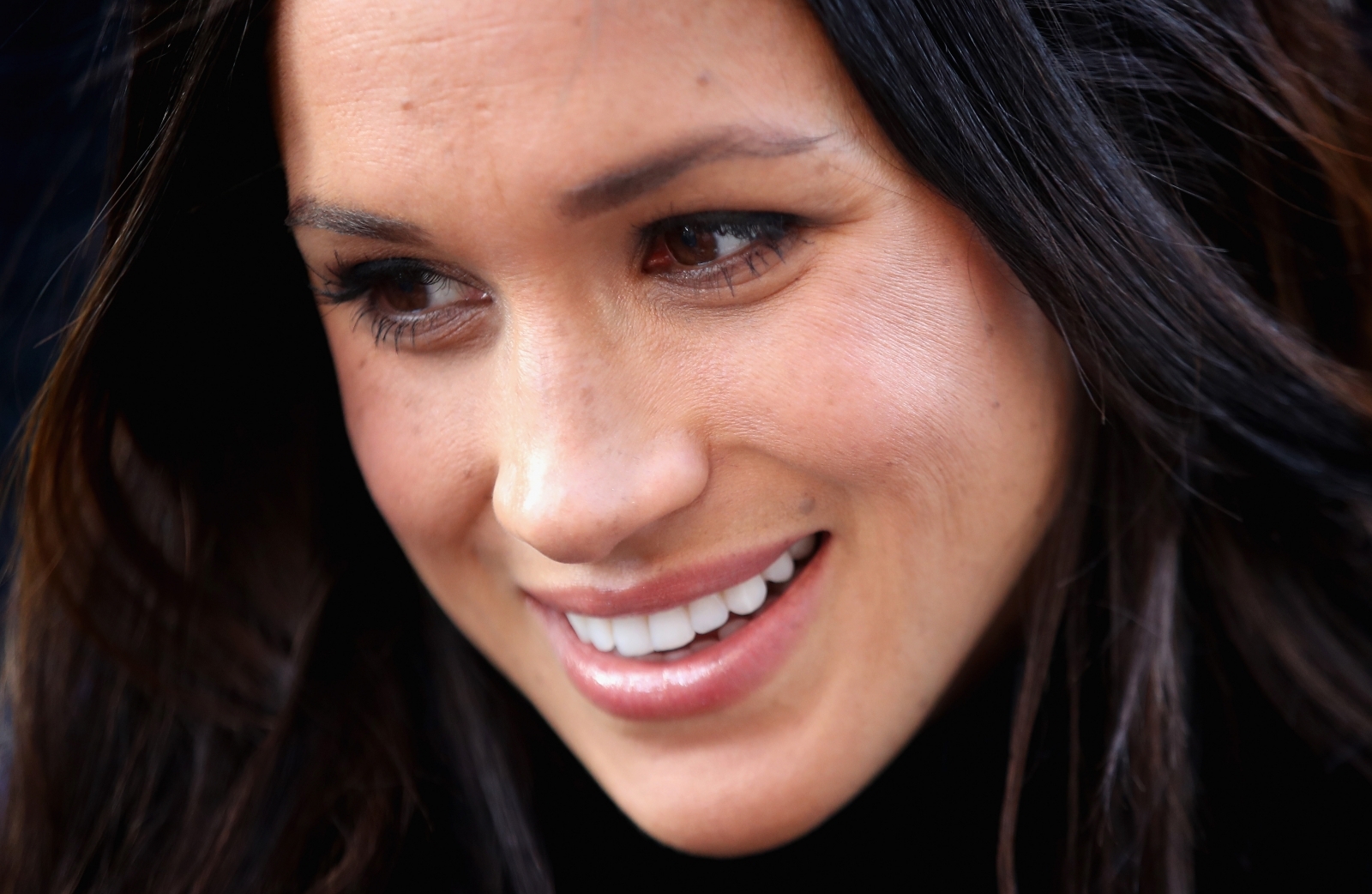 Meghan Markle's nose: Why it is so popular and how much will it cost you?