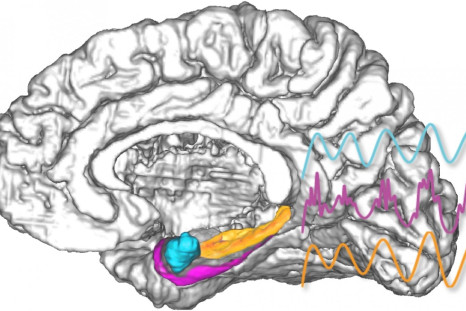Brain amygdala electrical stimulation