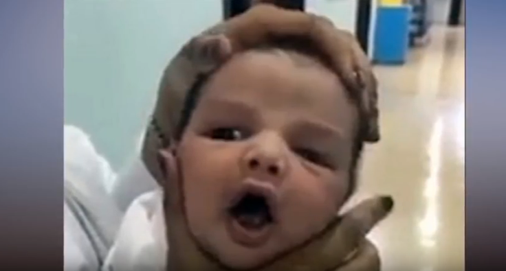 Saudi nurses squashed a newborn baby’s face 