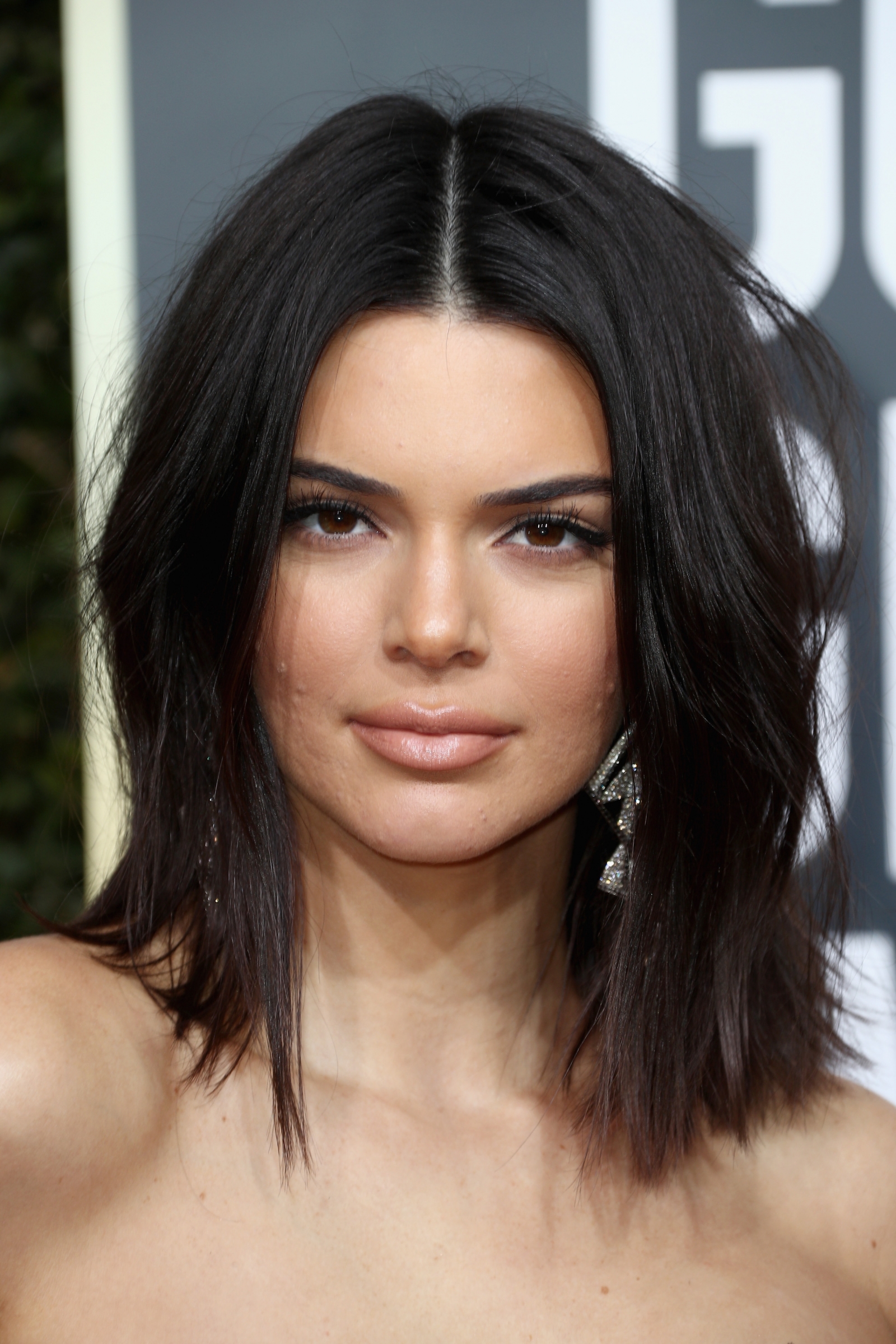 Kendall Jenner Acne At Golden Globes Sparks Fierce Twitter Debate We All Get Pimples