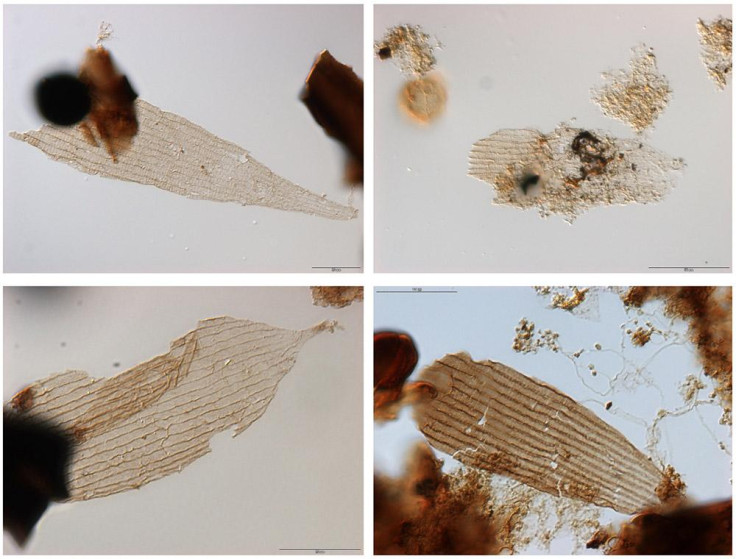 Fossil scales of moths and butterflies 