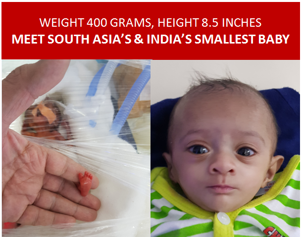 Miracle baby india
