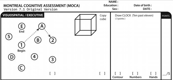 moca test score ranges