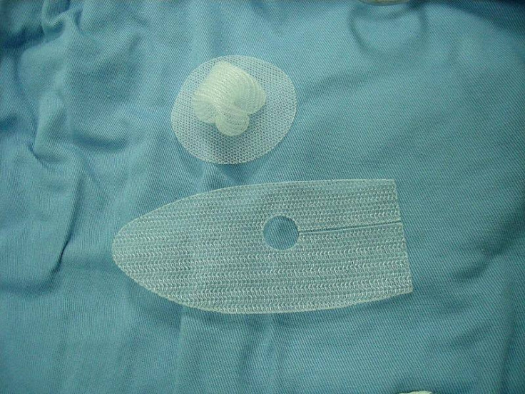 hernia mesh