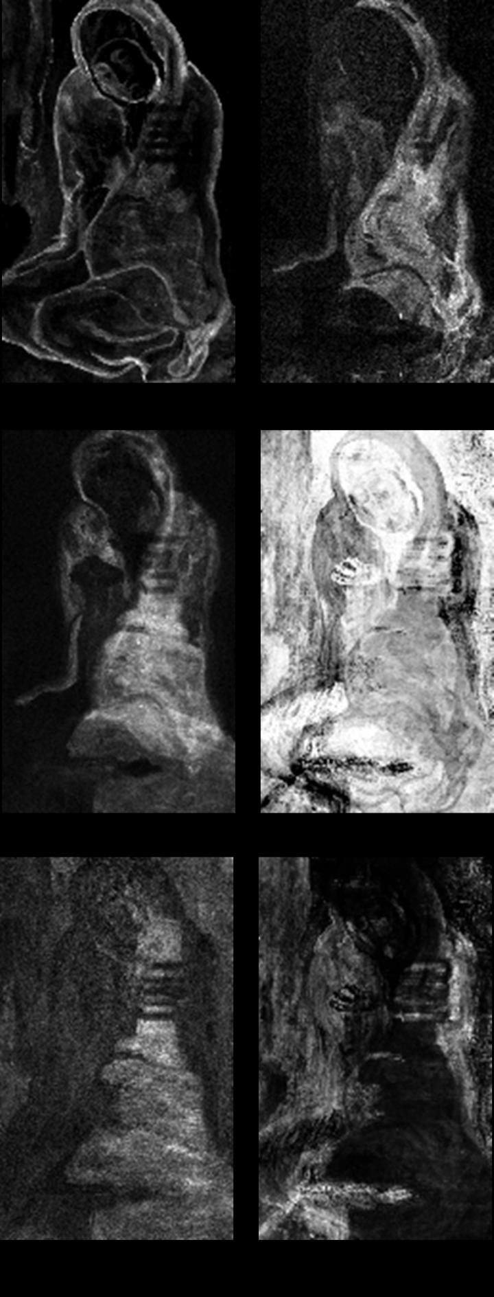 La miseruese accroupie x-rays