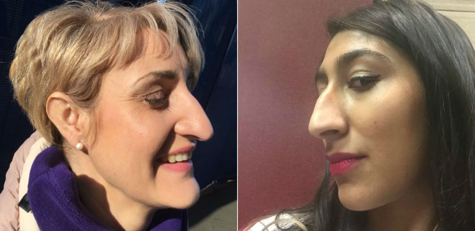 Why pictures of big noses have taken over your social feeds