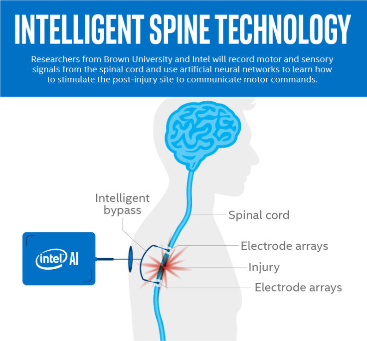 Intel AI spinal cord tech